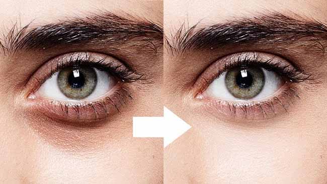 Serum Vitamin C làm giảm sự xuất hiện của quầng thâm dưới mắt