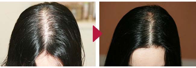 Sử dụng serum Bưởi rất có lợi để cải thiện tình trạng rụng tóc.
